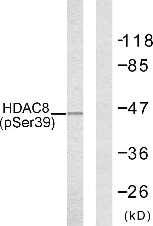 Polyclonal Rabbit anti-Human HDAC8 Antibody (phospho-Ser39, IHC, WB)