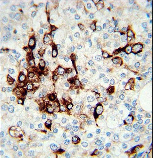 Vimentin Antibody (aa152-181)