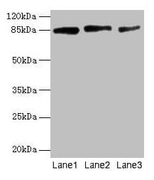 Polyclonal Rabbit anti-Human PLOD2 Antibody