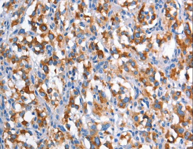 DNAM-1 / CD226 Antibody