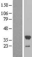 Human SULT1E1 / Sulfotransferase 1E1 Protein (Over-Expression Lysate Myc-DDK (Flag))