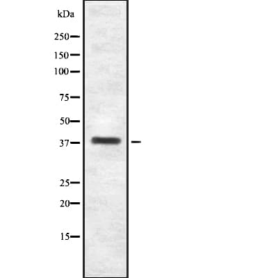 Polyclonal Rabbit anti-Human ITGB1BP2 / MELUSIN Antibody (WB)