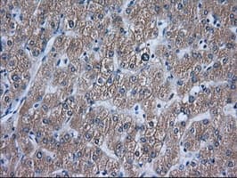 ACAT2 Antibody (clone OTI1B7)