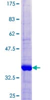 Human TIMM8B Protein (Recombinant GST)