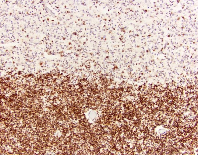 Goat Anti-Mouse IgG Secondary Antibody (HRP)