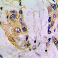 CYP4V2 Antibody