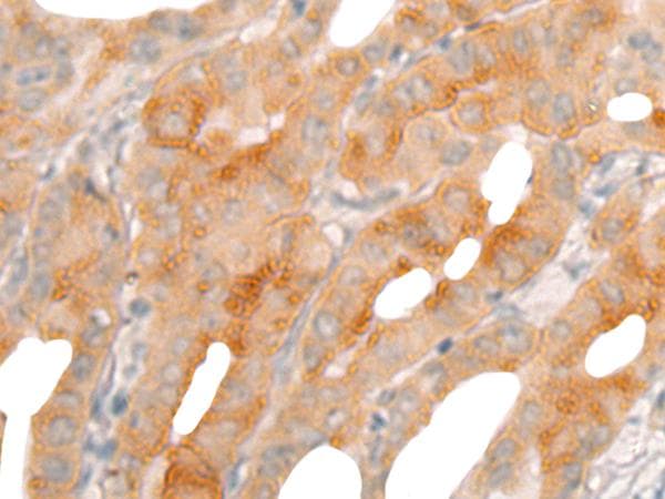 BBOX1 / BBOX Antibody