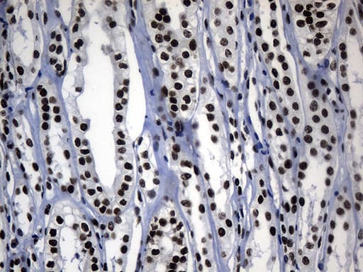 Monoclonal Mouse anti-Human POLR2A / RNA polymerase II Antibody (clone OTI3C8, aa1351-1614, IHC, WB)
