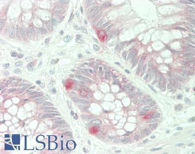 IHC-plus™ TPH1 / Tryptophan Hydroxylase Antibody