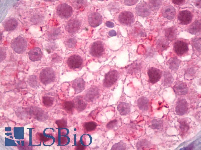 IHC-plus™ CCNE1 / Cyclin E1 Antibody (aa43-92)