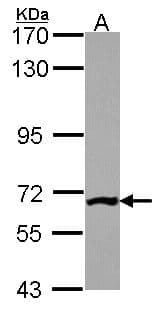 PGM3 Antibody (aa44-321)