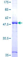 Human DCXR Protein (Recombinant GST)