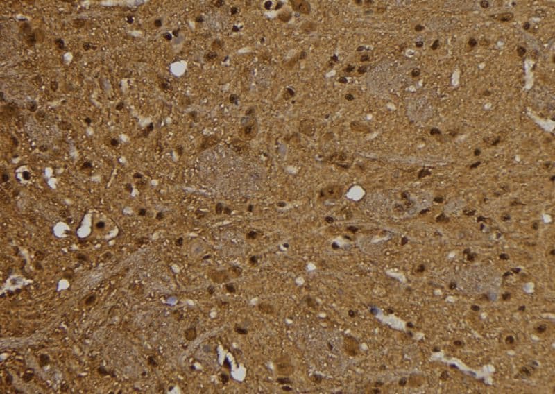PSME1 Antibody
