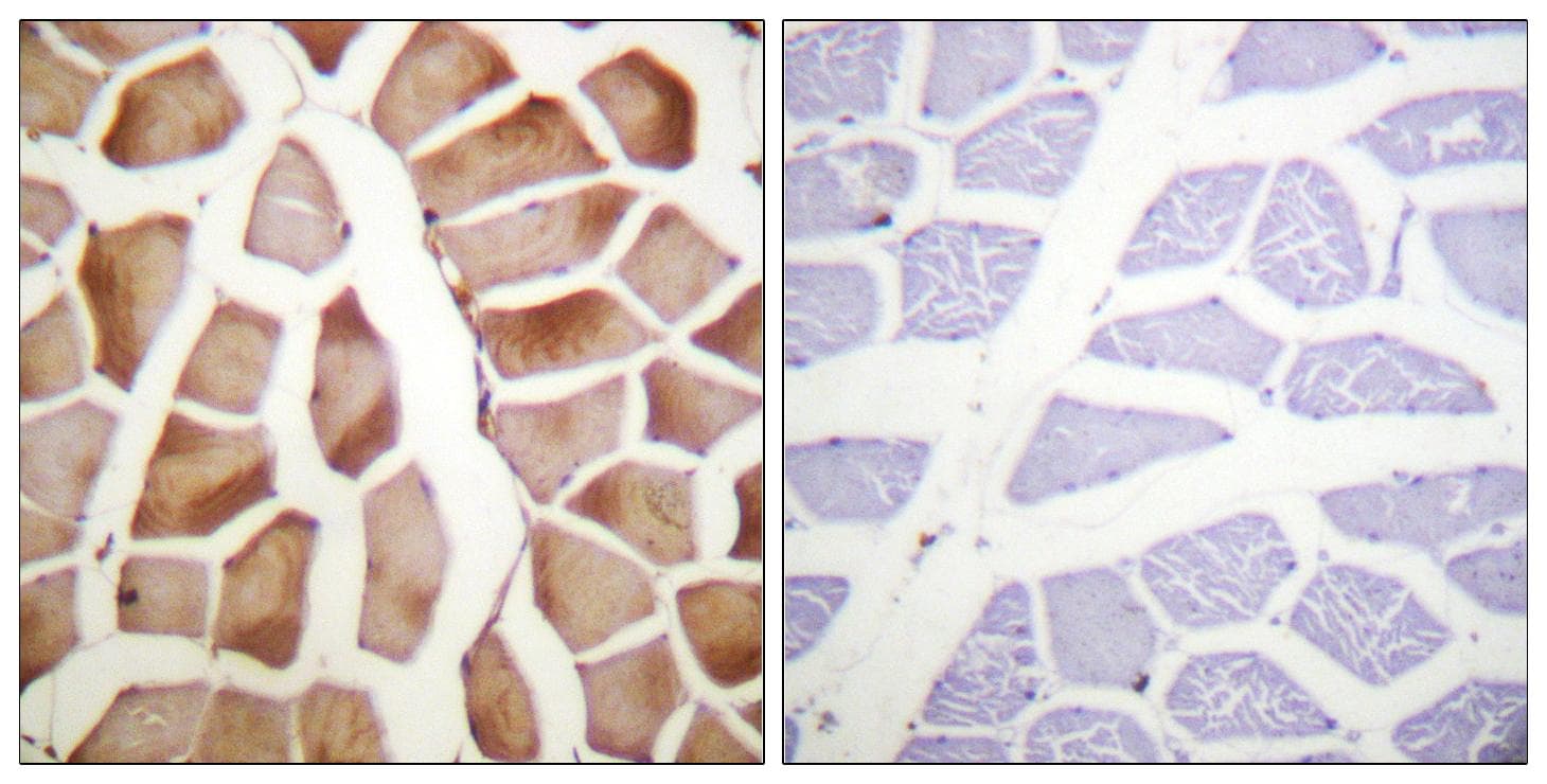 Polyclonal Rabbit anti-Human MRLC2 / MYL12B Antibody (IHC, IF)