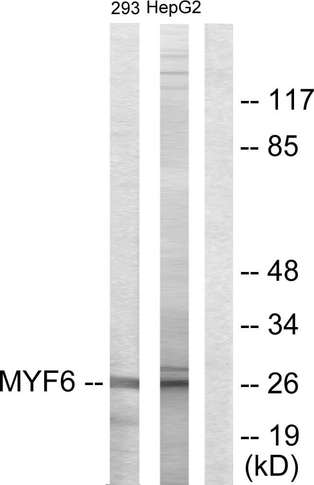 Polyclonal Rabbit anti-Human MYF6 / MRF4 Antibody (aa116-165, WB)