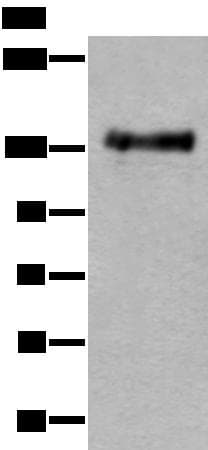 PTPRA / RPTP-Alpha Antibody