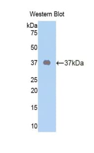 OXTR / Oxytocin Receptor Antibody (aa6-75)