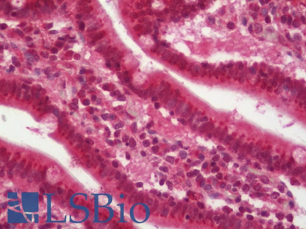 IHC-plus™ 4E-BP2 / EIF4EBP2 Antibody