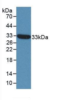 ST14 / Matriptase Antibody (aa607-852, HRP)