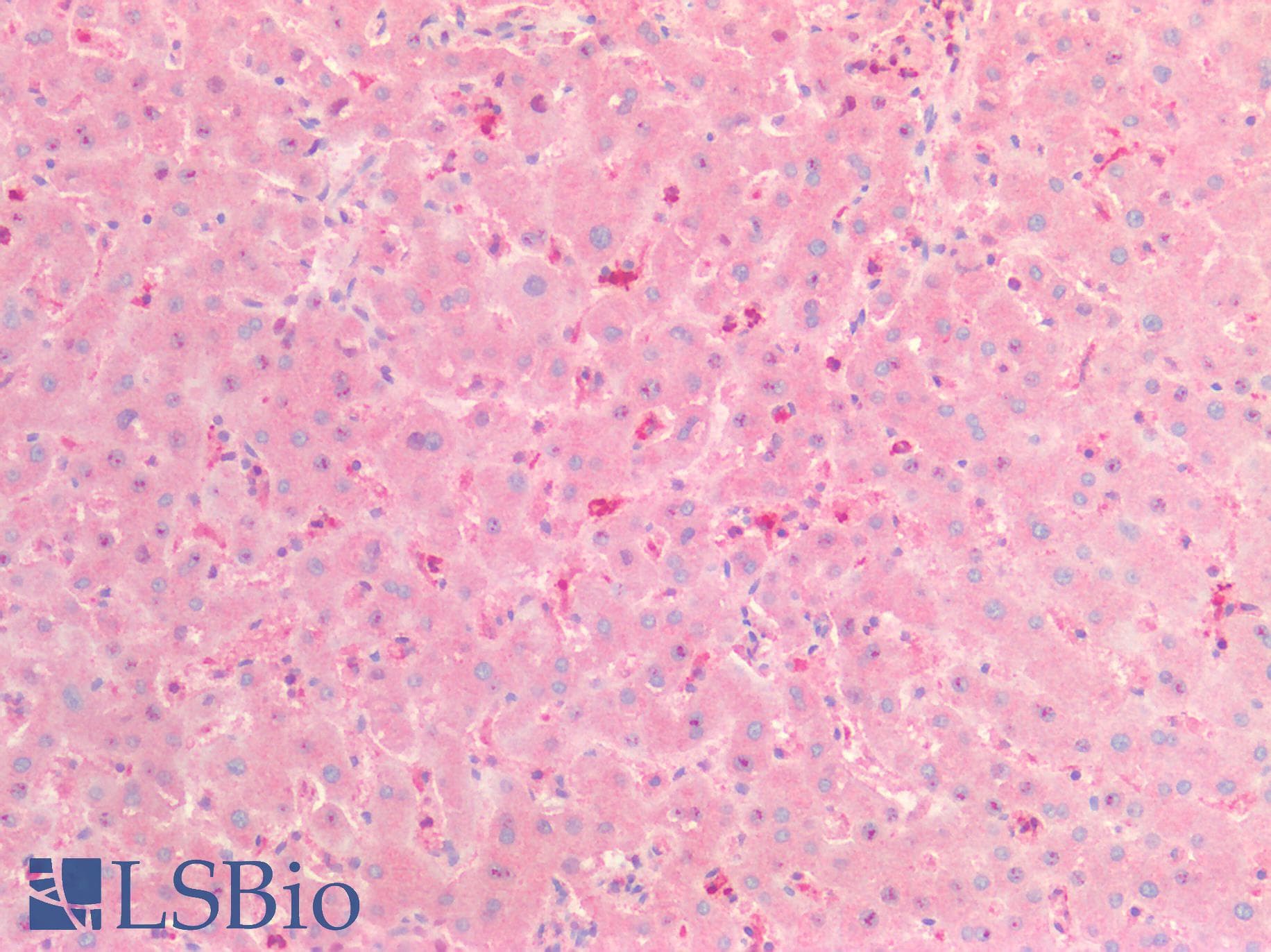 IHC-plus™ Polyclonal Sheep anti-Human Alpha-1-Antichymotrypsin Antibody (IHC)