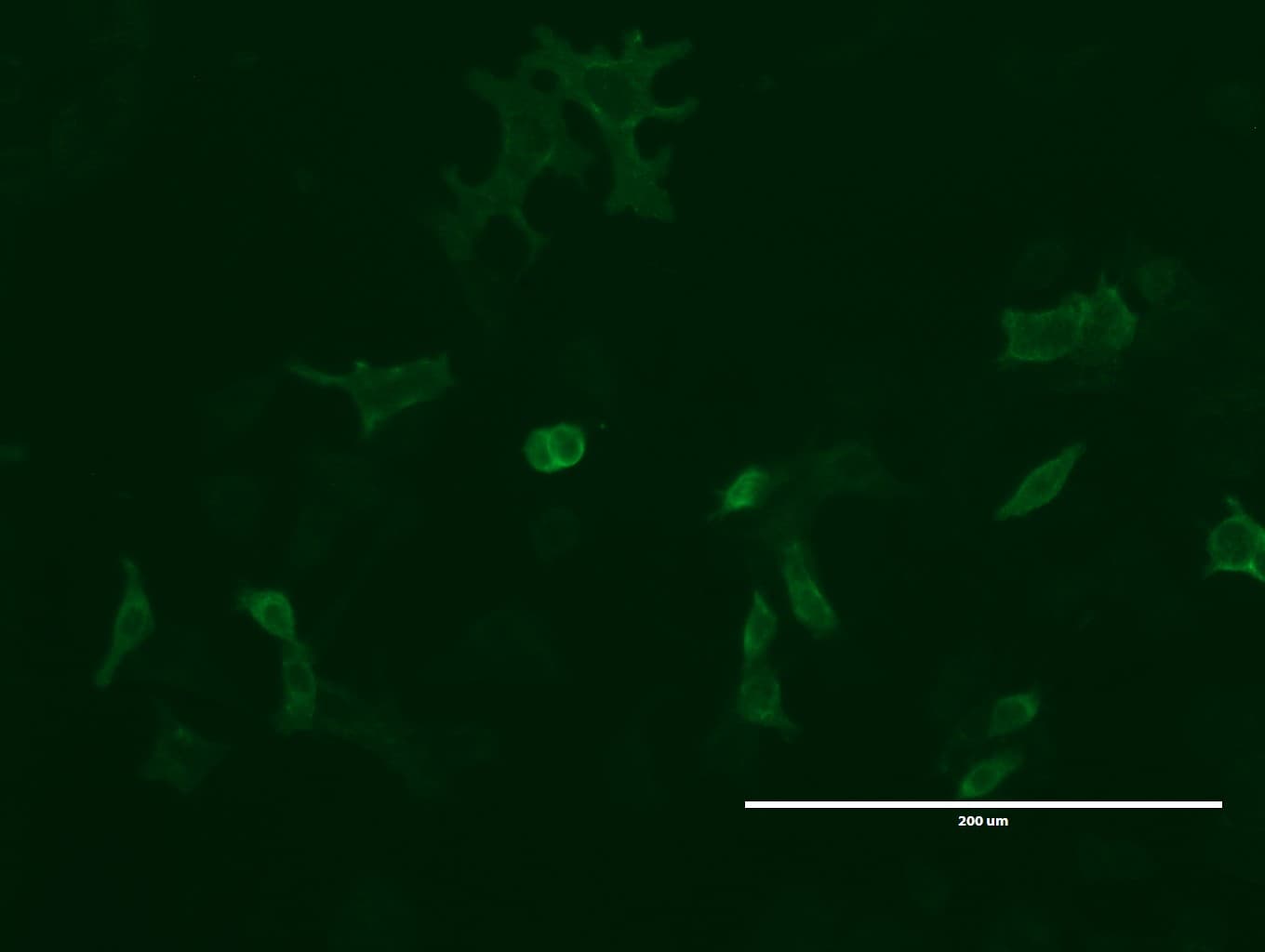 GPR49 / LGR5 Antibody (aa22-543, clone UMAB210, Carrier-free)