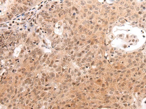 C14orf169 / NO66 Antibody