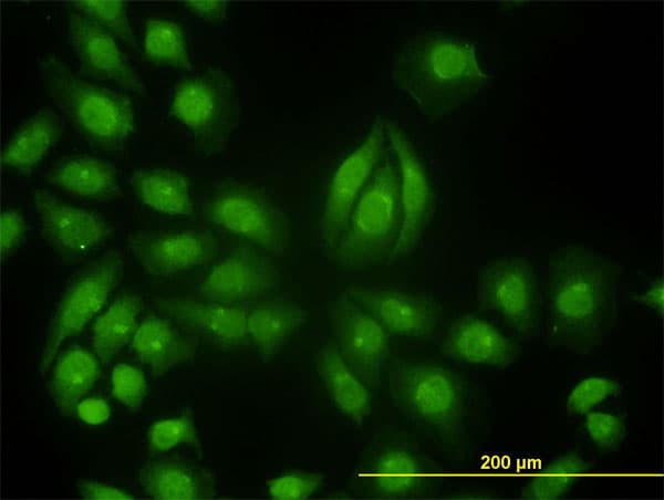 TYK2 Antibody (clone 6G12)