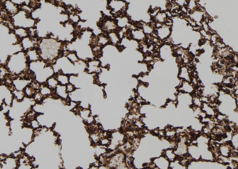 Polyclonal Rabbit anti-Human HEPACAM Antibody (IHC, WB)