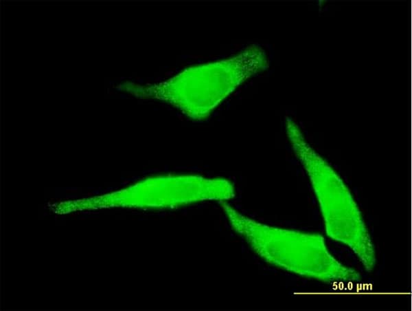 Monoclonal Mouse anti-Human NT5C2 Antibody (clone 3C1, IHC, IF, WB)