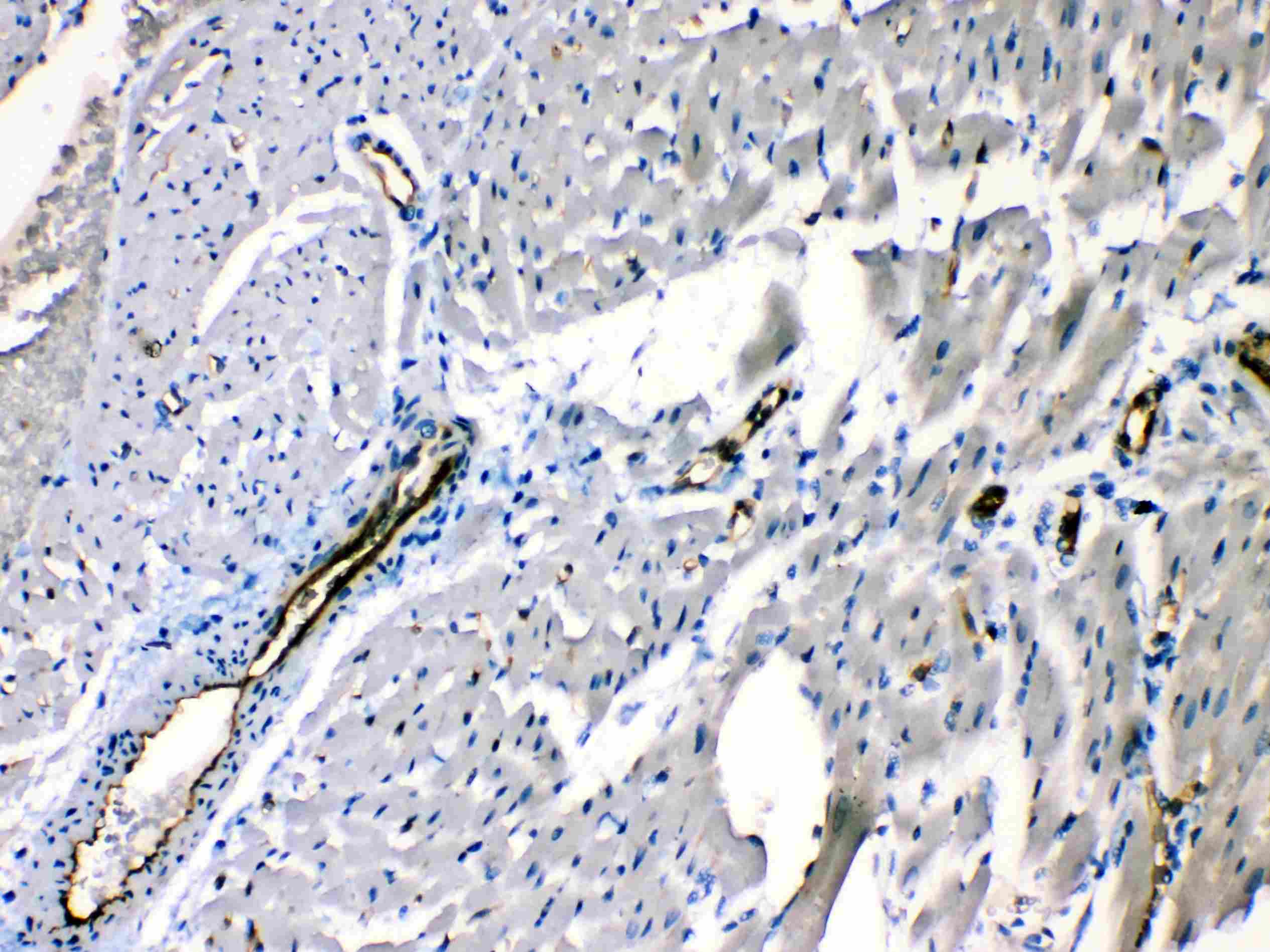 Polyclonal Rabbit anti-Human ANGPTL2 / ARP2 Antibody (IHC, WB)