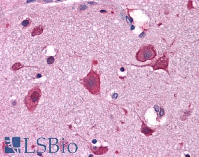 IHC-plus™ Polyclonal Rabbit anti-Human IRGC1 / CINEMA Antibody (IHC, IF, WB)