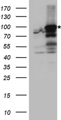 ANKRD52 Antibody