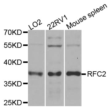 RFC2 / RFC40 Antibody