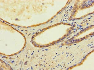 Polyclonal Rabbit anti-Human FAM70B Antibody