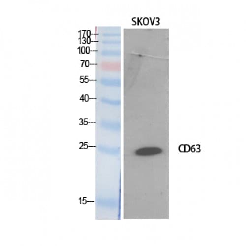 Polyclonal Rabbit anti-Human CD63 Antibody (121-170 aa, Internal, IHC, WB)