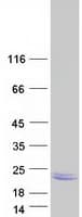 Human LEMD1 Protein (Recombinant Myc-DDK (Flag))