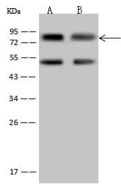 MYST2 / HBO1 Antibody