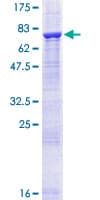 Human ACCS / ACS Protein (Recombinant GST)
