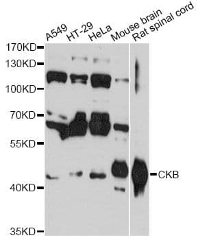 CKB / Creatine Kinase BB Antibody