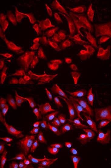 BCL2L13 / Bcl Rambo Antibody