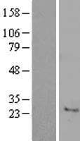 C7orf33 Protein (Over-Expression Lysate Myc-DDK (Flag))