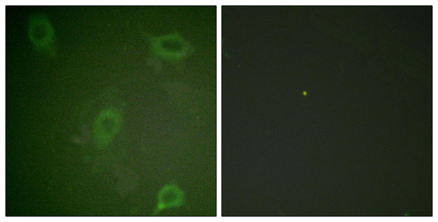 Polyclonal Rabbit anti-Human APP / Beta Amyloid Precursor Antibody (phospho-Thr743/668, IHC, IF, WB)