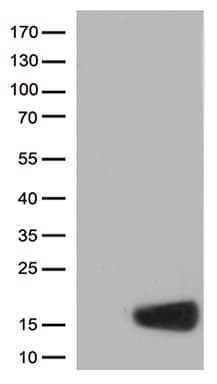 CSTB / Cystatin B / Stefin B Antibody (aa1-98, clone OTI3D5)