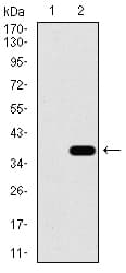 SLC27A5 / BACS Antibody (aa508-570, clone 9C4D1)