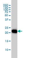 IHC-plus™ Monoclonal Mouse anti-Human RHOA Antibody (clone 1B12, IHC, IF, WB)