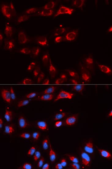 IHC-plus™ Polyclonal Rabbit anti-Human Properdin / CFP Antibody (IHC, IF, WB)