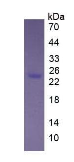 Human FKBP7 Protein (Recombinant)