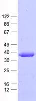 Human PPP4C Protein (Recombinant His, N-Terminal)