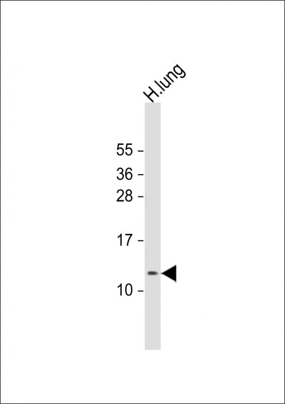DKK3 Antibody (aa58-87)