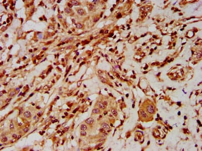 Polyclonal Rabbit anti-Human ELP2 / STATIP1 Antibody (IHC, IF)